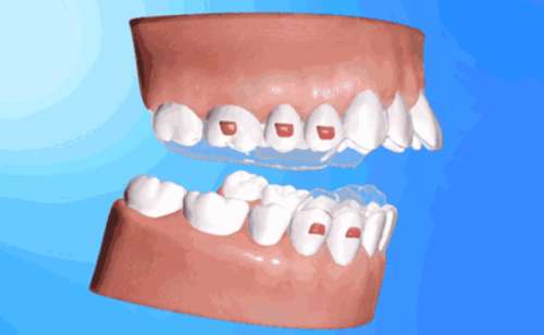 http://www.chicagonutritionsolutions.com/d/file/price/er5agw28u851.jpg