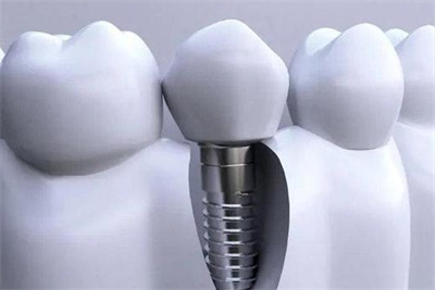 http://www.chicagonutritionsolutions.com/d/file/price/fnzgykfwd1yh.jpg