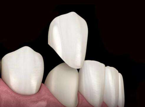 http://www.chicagonutritionsolutions.com/d/file/price/fpo4o18hcvpl.jpg