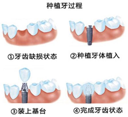 長(zhǎng)沙牙大夫口腔醫(yī)院實(shí)力大起底：口碑、特色、價(jià)格指南