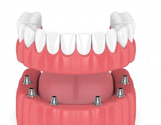 http://www.chicagonutritionsolutions.com/d/file/price/ftsc3qr1338t.jpg