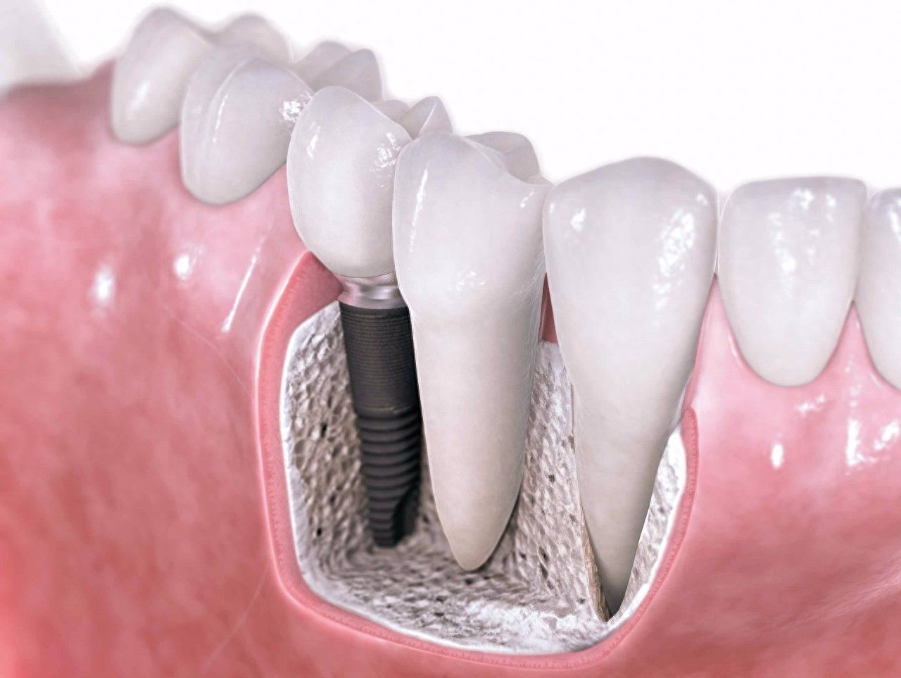 http://www.chicagonutritionsolutions.com/d/file/price/fwruk3b5cdsg.jpg