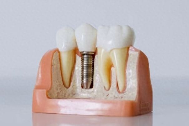 http://www.chicagonutritionsolutions.com/d/file/price/fzswjnv1rld2.jpg