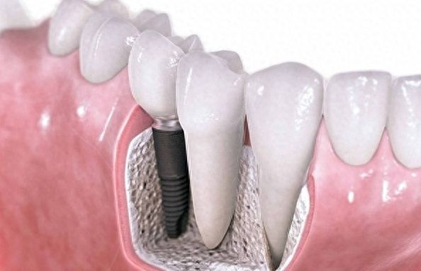 http://www.chicagonutritionsolutions.com/d/file/price/g1hl3126wtqa.jpg