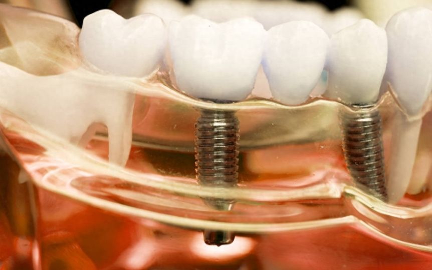 http://www.chicagonutritionsolutions.com/d/file/price/glz4c181e46u.jpg