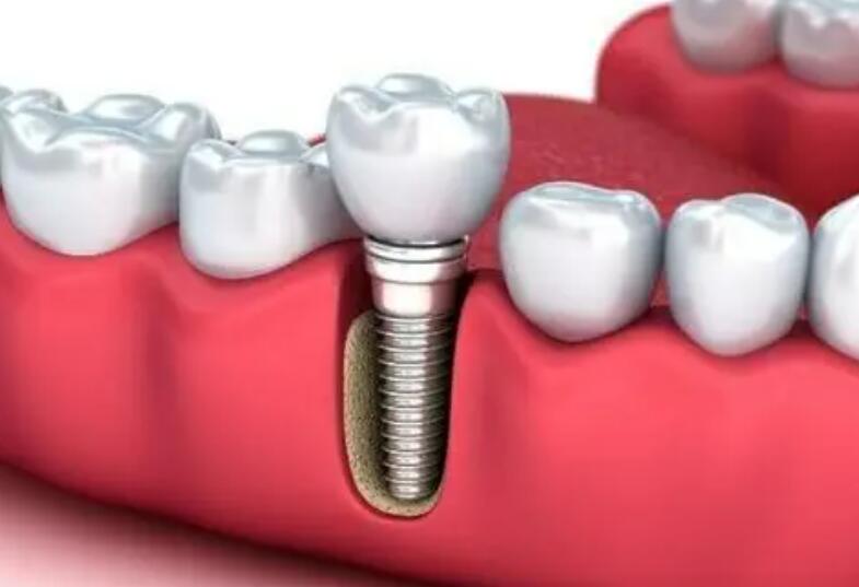 http://www.chicagonutritionsolutions.com/d/file/price/gniddbv04bku.jpg