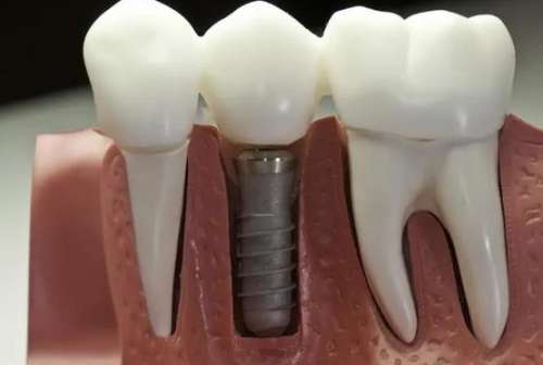 http://www.chicagonutritionsolutions.com/d/file/price/gtx3acm33sty.jpg