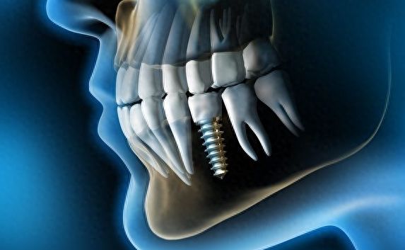 http://www.chicagonutritionsolutions.com/d/file/price/gv6csrkrio8v.jpg