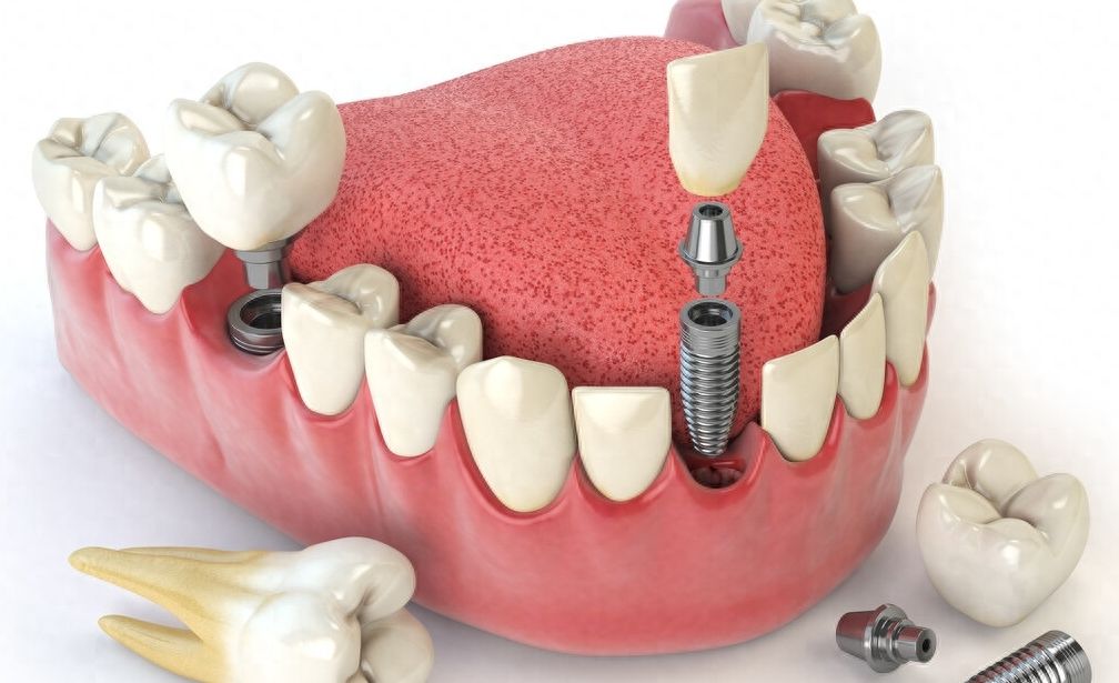 http://www.chicagonutritionsolutions.com/d/file/price/gwuqg2ead8si.jpg