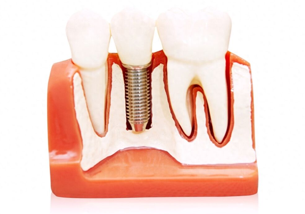 http://www.chicagonutritionsolutions.com/d/file/price/gyofttyzgtec.jpg