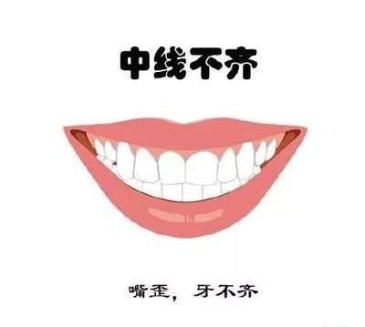 西寧牙齒矯正費用一覽，隱形矯正價格參考指南
