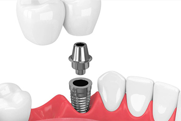 http://www.chicagonutritionsolutions.com/d/file/price/h2xfvbstzmu1.jpg