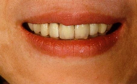 http://www.chicagonutritionsolutions.com/d/file/price/h9vijw83cz5d.jpg