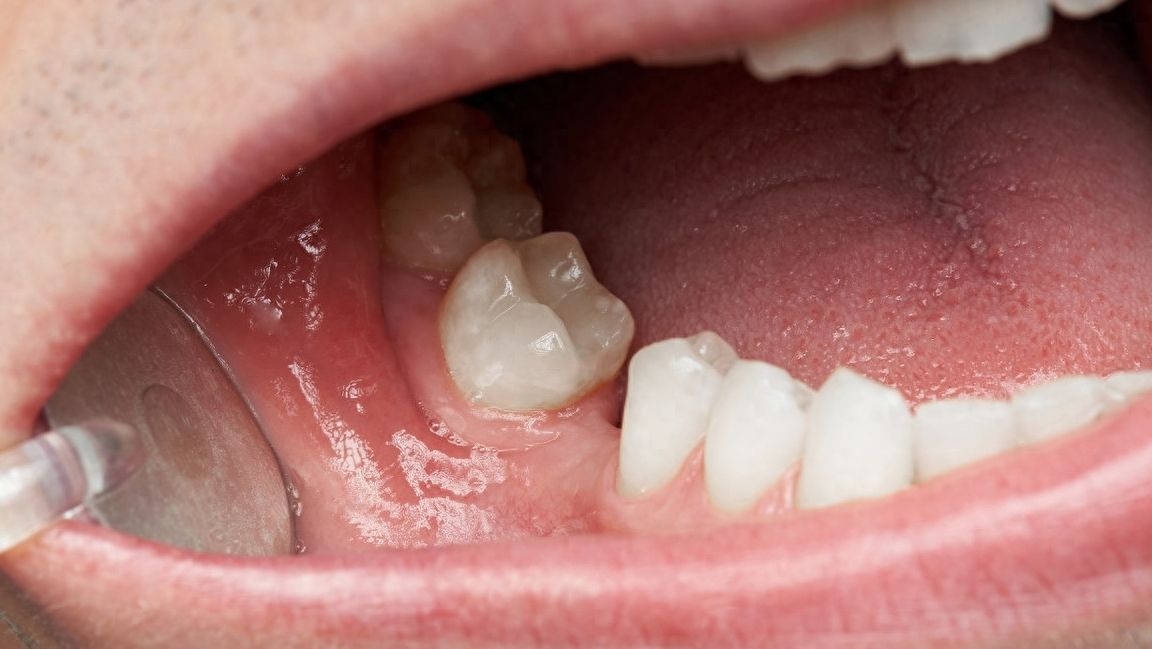 http://www.chicagonutritionsolutions.com/d/file/price/hivbnlpf33jz.jpg