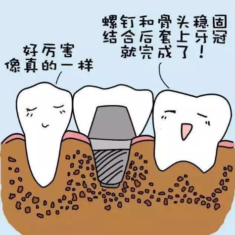喀什柏賽佳口腔收費貴嗎？價格表參考，連鎖機構(gòu)也能放心種牙！