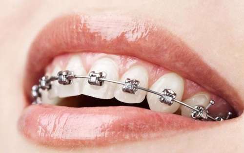 http://www.chicagonutritionsolutions.com/d/file/price/hp35fvrp7dlm.jpg
