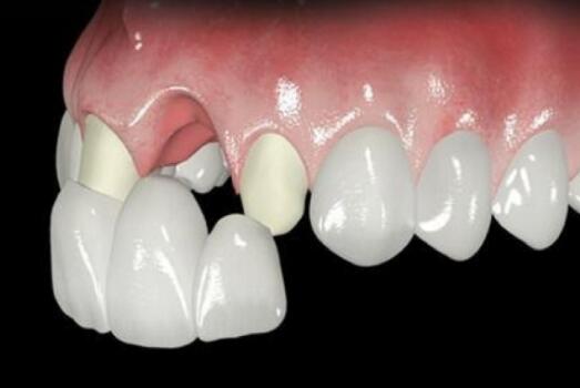 http://www.chicagonutritionsolutions.com/d/file/price/hspi31ovizck.jpg