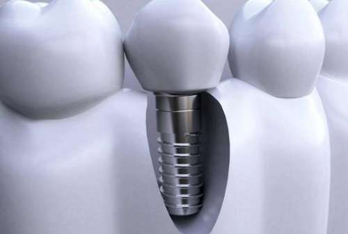http://www.chicagonutritionsolutions.com/d/file/price/i4pot4qm0178.jpg