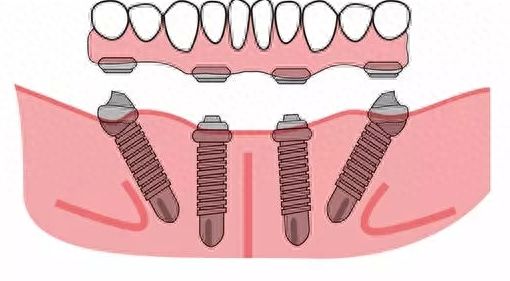 http://www.chicagonutritionsolutions.com/d/file/price/ic4lghf4vc0x.jpg