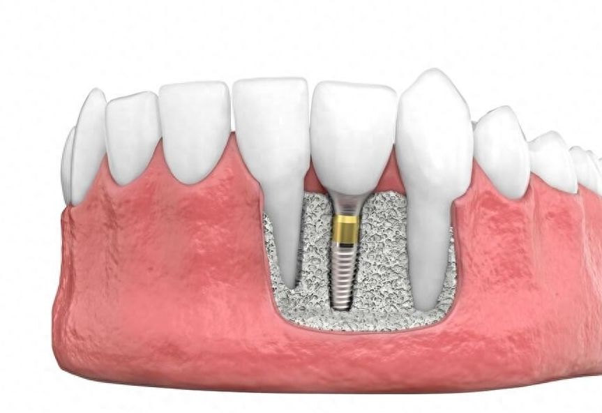 http://www.chicagonutritionsolutions.com/d/file/price/ifz2ouyh2laf.jpg