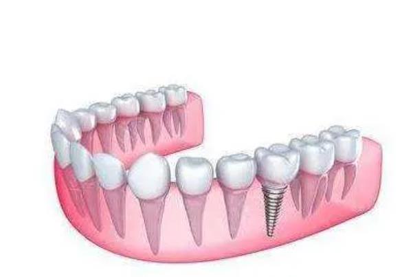 http://www.chicagonutritionsolutions.com/d/file/price/im6a1a6jsgpn.jpg