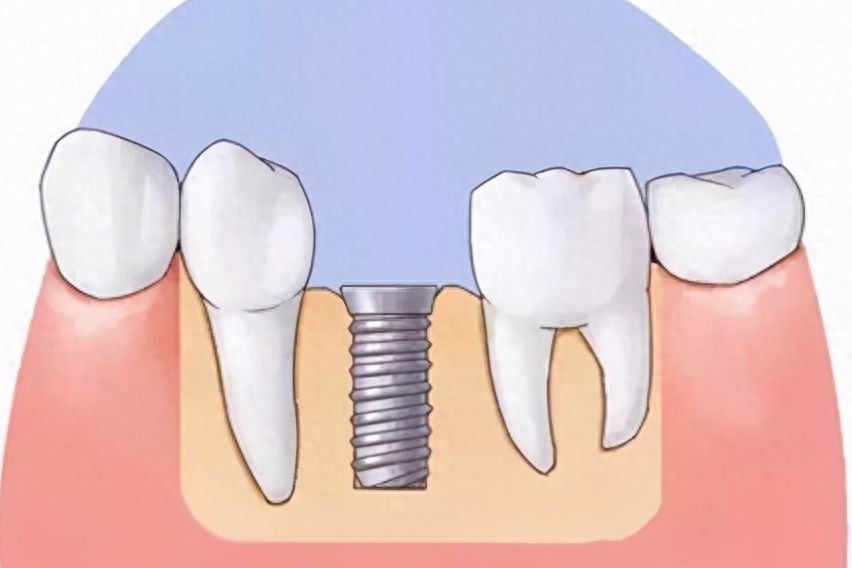 http://www.chicagonutritionsolutions.com/d/file/price/iornaftvo9iq.jpg