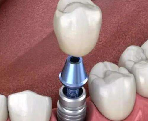 http://www.chicagonutritionsolutions.com/d/file/price/ithmi2w66um1.jpg