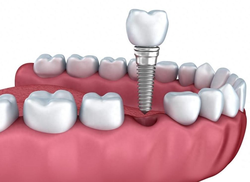 http://www.chicagonutritionsolutions.com/d/file/price/iu1vdkf9slk2.jpg