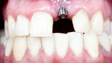 http://www.chicagonutritionsolutions.com/d/file/price/j3jdn4hp53ma.jpg