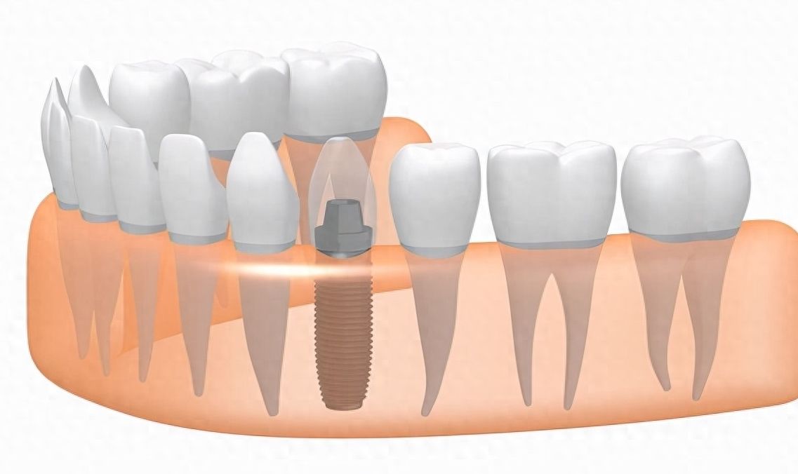 http://www.chicagonutritionsolutions.com/d/file/price/jeq4f949mm0b.jpg