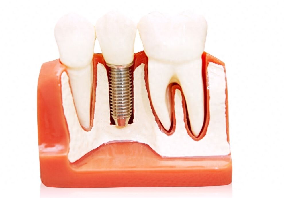 http://www.chicagonutritionsolutions.com/d/file/price/jjkul7v3075c.jpg