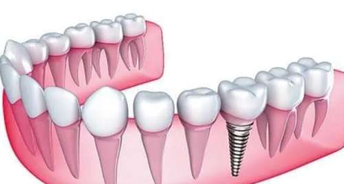 http://www.chicagonutritionsolutions.com/d/file/price/jo0oey6hlrmq.jpg