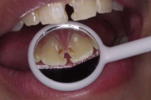 http://www.chicagonutritionsolutions.com/d/file/price/k912g604culy.jpg