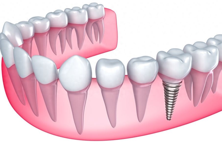 http://www.chicagonutritionsolutions.com/d/file/price/kmziishp0hbs.jpg