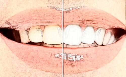 http://www.chicagonutritionsolutions.com/d/file/price/kwaaj1b7oi87.jpg