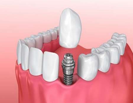 http://www.chicagonutritionsolutions.com/d/file/price/lgkrutan9vo8.jpg