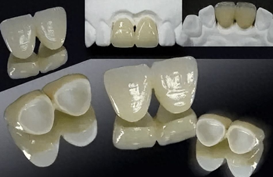 http://www.chicagonutritionsolutions.com/d/file/price/loi95arc32lf.jpg