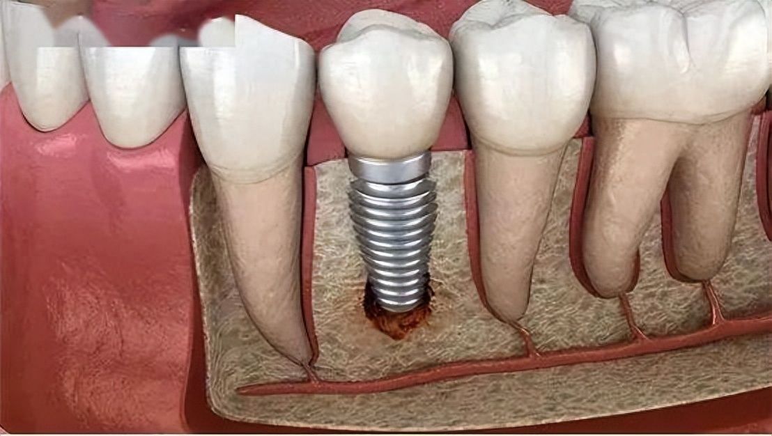 http://www.chicagonutritionsolutions.com/d/file/price/mbkg5maz1r3j.jpg