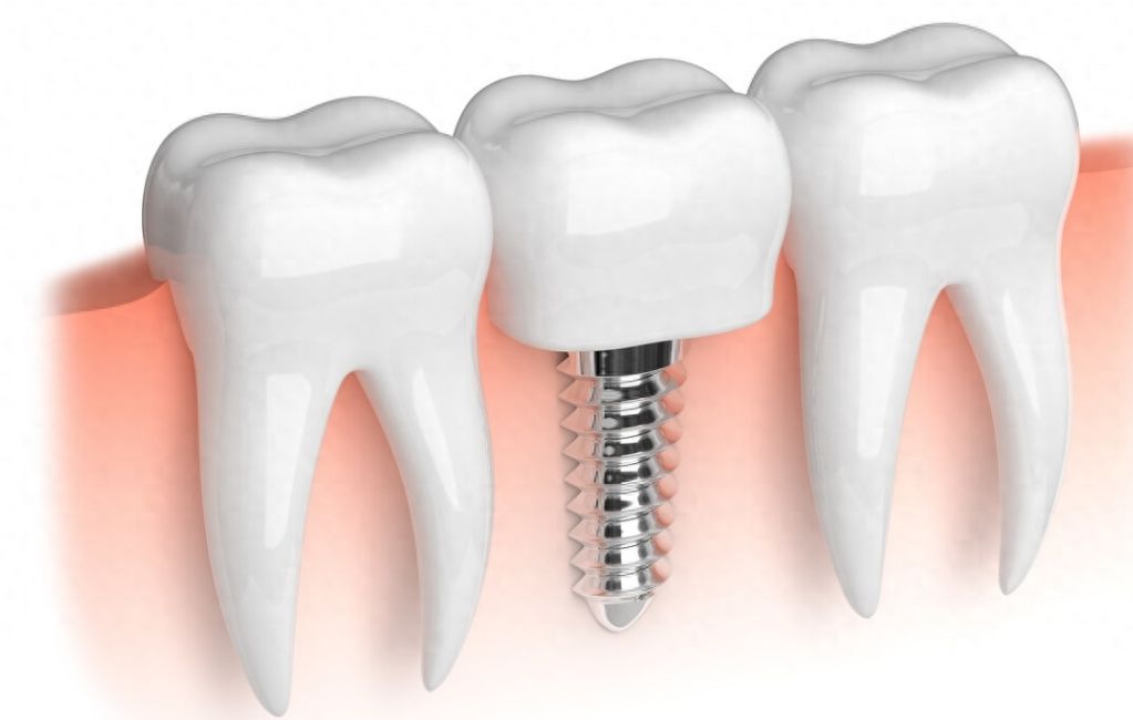 http://www.chicagonutritionsolutions.com/d/file/price/molahe231l.jpg
