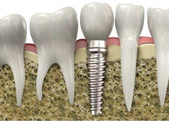 http://www.chicagonutritionsolutions.com/d/file/price/n1vsgbm02qby.jpg