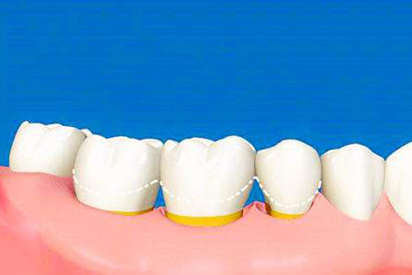 http://www.chicagonutritionsolutions.com/d/file/price/n6wcut2wzkq4.jpg