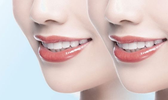 http://www.chicagonutritionsolutions.com/d/file/price/nfle7elg7ld4.jpg