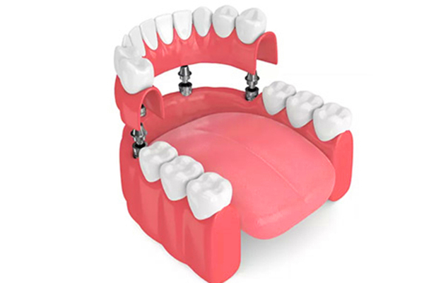 http://www.chicagonutritionsolutions.com/d/file/price/nmtfm1iyxt64.jpg