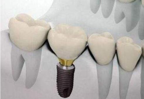 http://www.chicagonutritionsolutions.com/d/file/price/ntcgemge5d.jpg