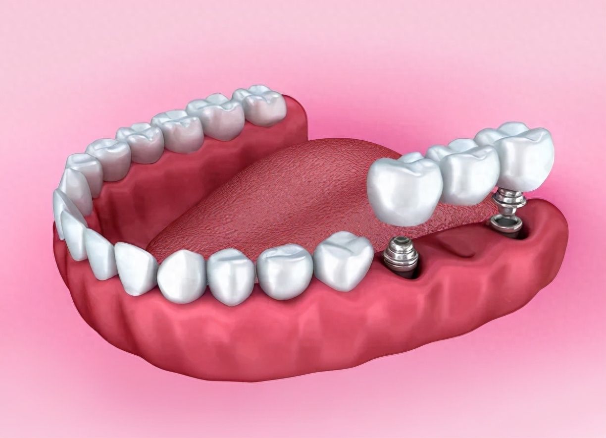 http://www.chicagonutritionsolutions.com/d/file/price/nujvv4li88et.jpg