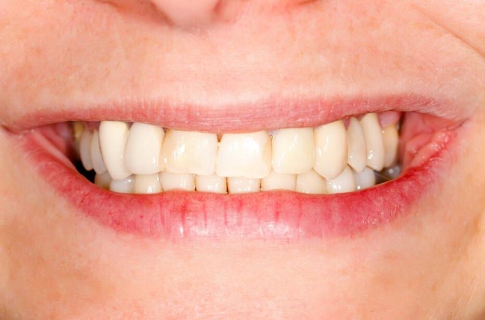 http://www.chicagonutritionsolutions.com/d/file/price/nx6xpw2gnoca.jpg