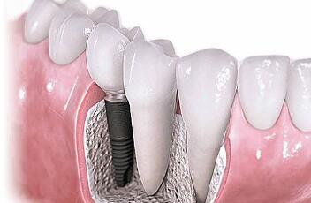 http://www.chicagonutritionsolutions.com/d/file/price/o5dh2te3nnst.jpg