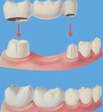http://www.chicagonutritionsolutions.com/d/file/price/oophv1bew79g.jpg