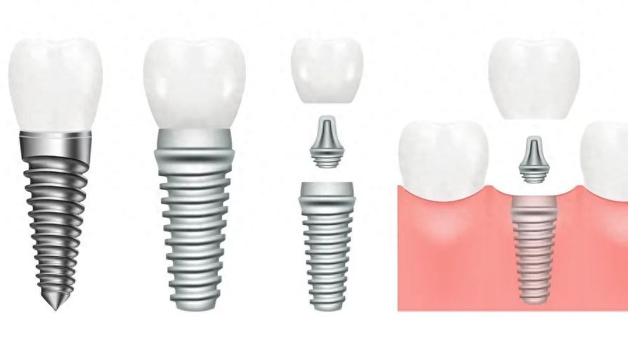 http://www.chicagonutritionsolutions.com/d/file/price/pai28940grkv.jpg