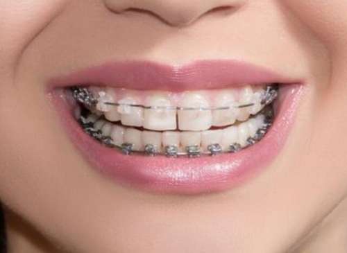 http://www.chicagonutritionsolutions.com/d/file/price/pr2i27yul2jv.jpg